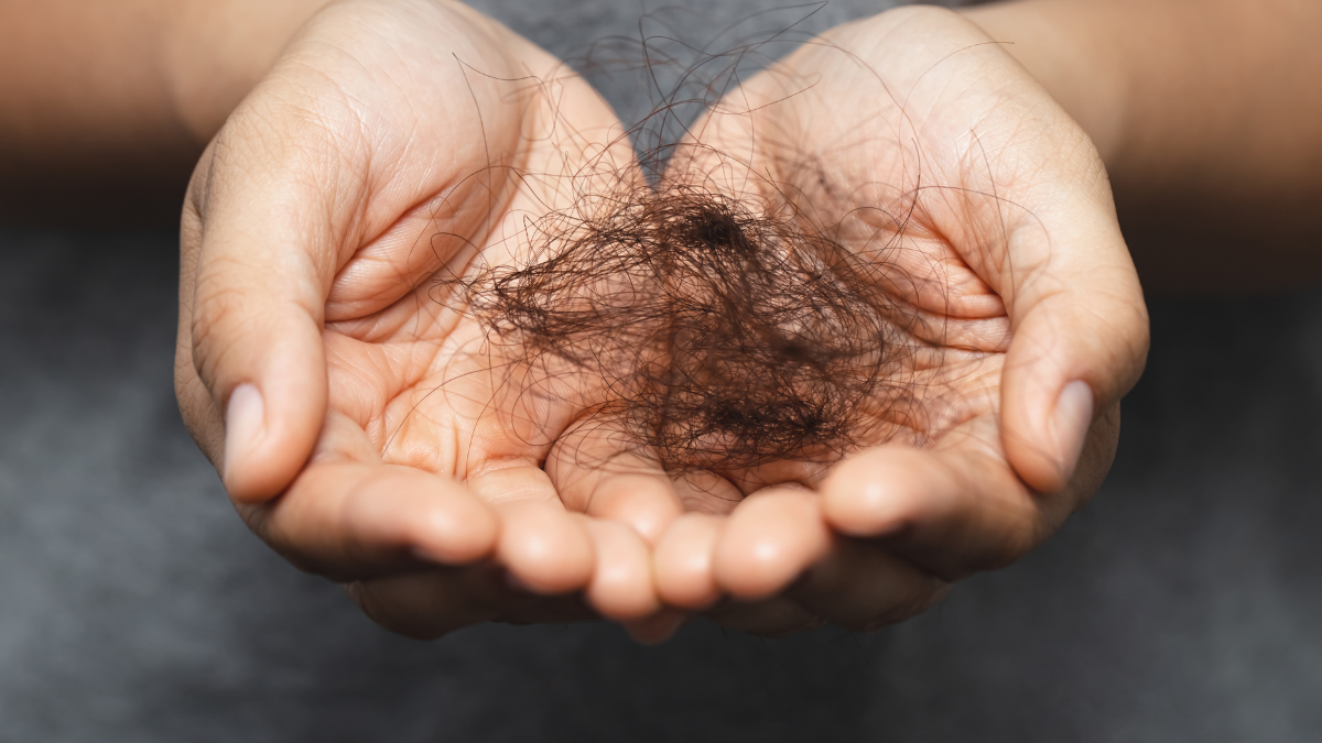 Understanding Hair Loss and Laser Treatment Solutions